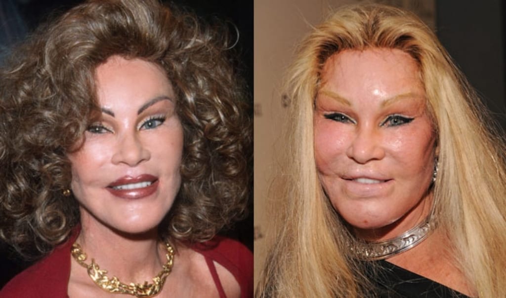 10 Celebrities Who Were Almost Unrecognisable After Plastic Surgery